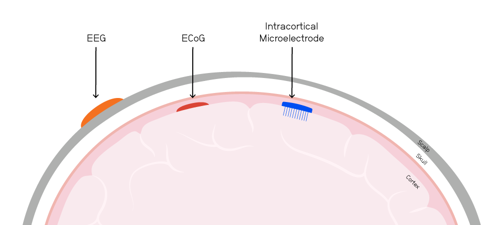 BCI electrode placement comparison