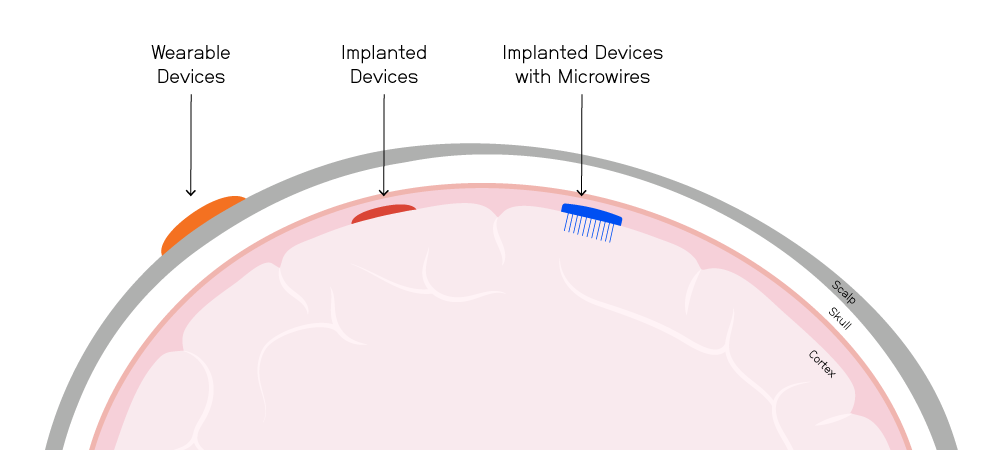 Cross section of the brain with different types of BCI electrodes and where they sit in the skull